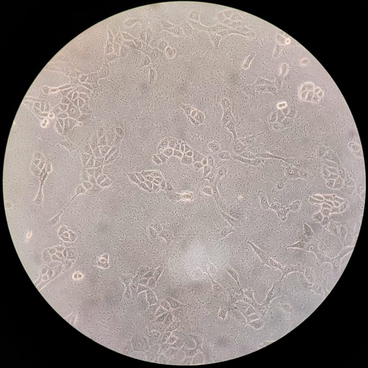 Cell Culture Contamination How to Prevent Fungal, Yeast, and Bacterial Cell Culture